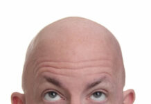 Vísindamenn nálgast lækningu á skalla