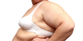 Tengsl eru á milli offitu og streitu