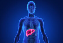 Bætiefni sem innihalda usnic-sýru eru bendluð við lifrarbilun