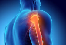 Testósterón hormónið er mikilvægt fyrir beinin