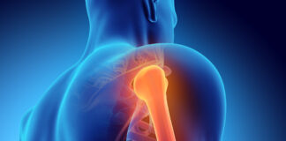 Testósterón hormónið er mikilvægt fyrir beinin