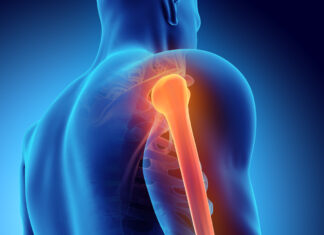 Testósterón hormónið er mikilvægt fyrir beinin