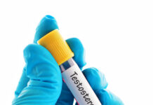 Breiður hópur sem notar stera