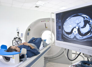 Jáeindaskanni varpar nýju ljósi á brúnu fituna