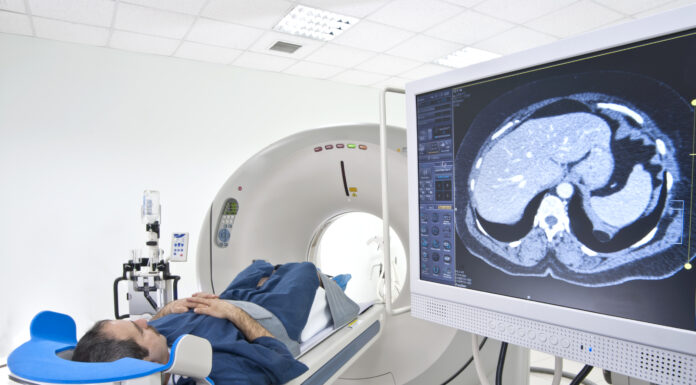 Jáeindaskanni varpar nýju ljósi á brúnu fituna